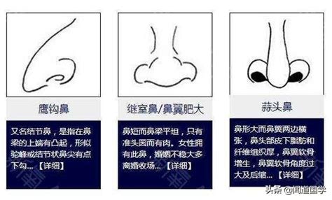 鼻生瘡面相|理財面相學｜5大破財面相特徵：鼻孔朝天之外還有哪些？－【七 